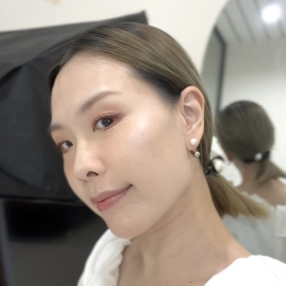 2023Dcard推薦彩衝光M22是什麼？花花臉、紅痘印、色素沈澱大掃除！台北悠美診所彩衝光M22體驗心得