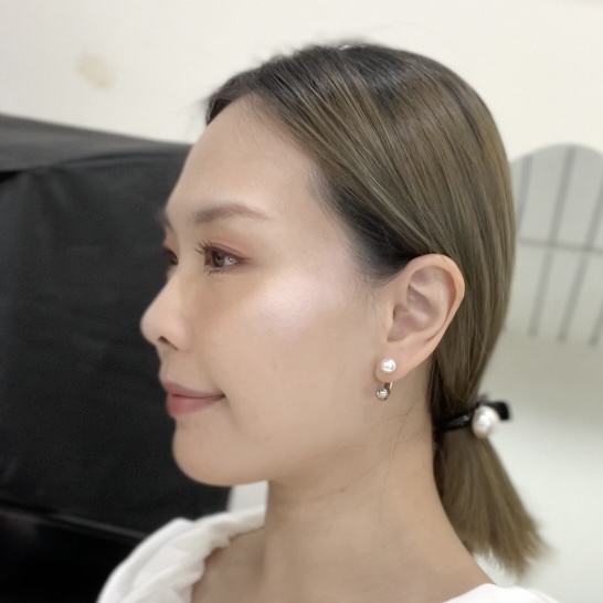 2023Dcard推薦彩衝光M22是什麼？花花臉、紅痘印、色素沈澱大掃除！台北悠美診所彩衝光M22體驗心得