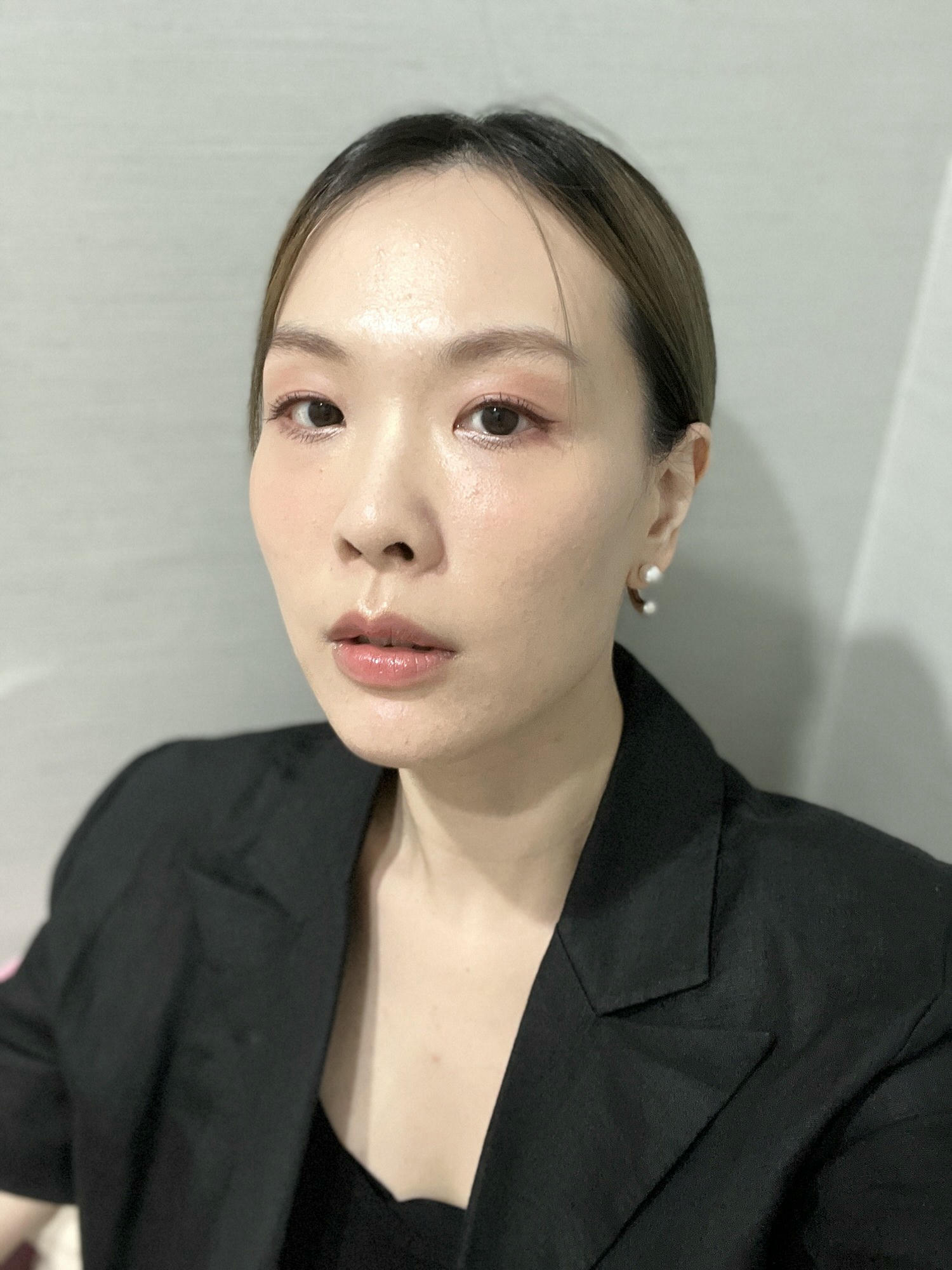 2023Dcard推薦彩衝光M22是什麼？花花臉、紅痘印、色素沈澱大掃除！台北悠美診所彩衝光M22體驗心得