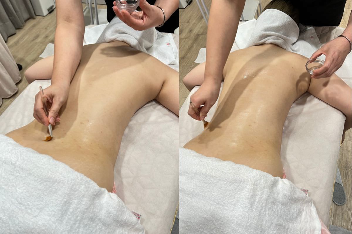 【杏仁酸美背推薦】背痘粉刺、暗沈毛孔滾開，手指滑倒般的觸感❤️台北花漾國際美學診所，超認真杏仁酸美背初體驗！