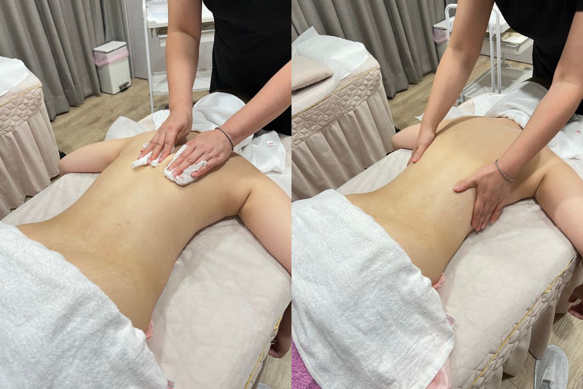 【杏仁酸美背推薦】背痘粉刺、暗沈毛孔滾開，手指滑倒般的觸感❤️台北花漾國際美學診所，超認真杏仁酸美背初體驗！