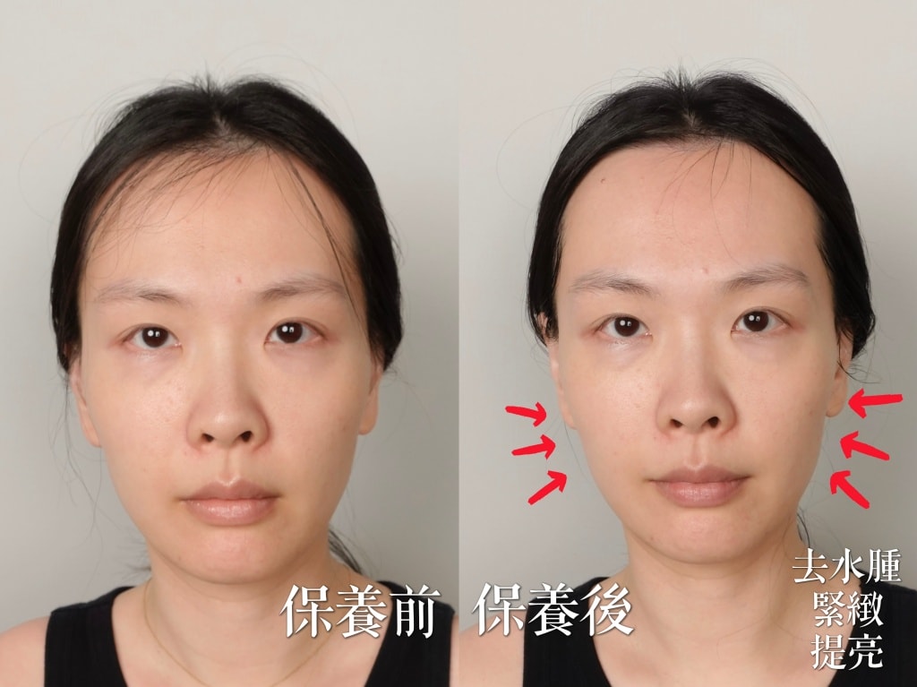 極萌大熨斗美容儀評價？微電流美容儀有用嗎？終於找到醫美的平替方案！