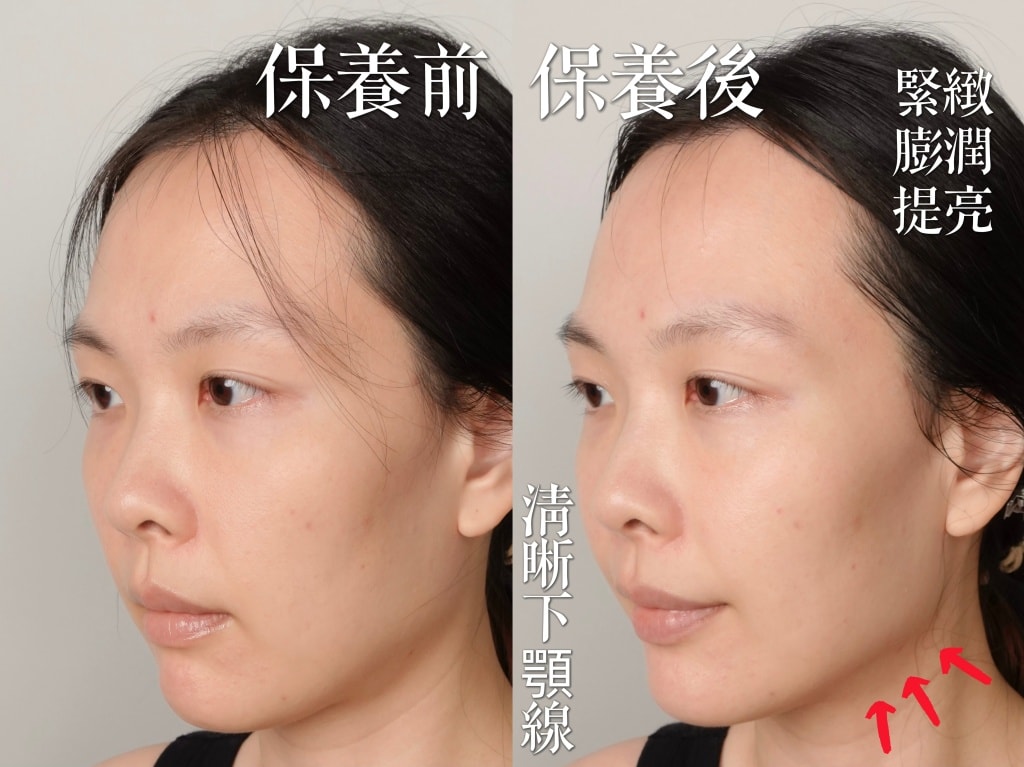 極萌大熨斗美容儀評價？微電流美容儀有用嗎？終於找到醫美的平替方案！