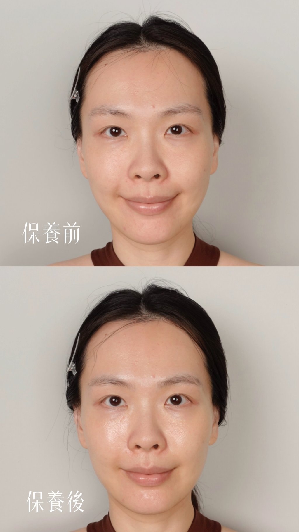 2024必敗！不痛的抗老微針保養！世界首創日本京藥妝牛磺酸微針，有感瞬拉緊緻！