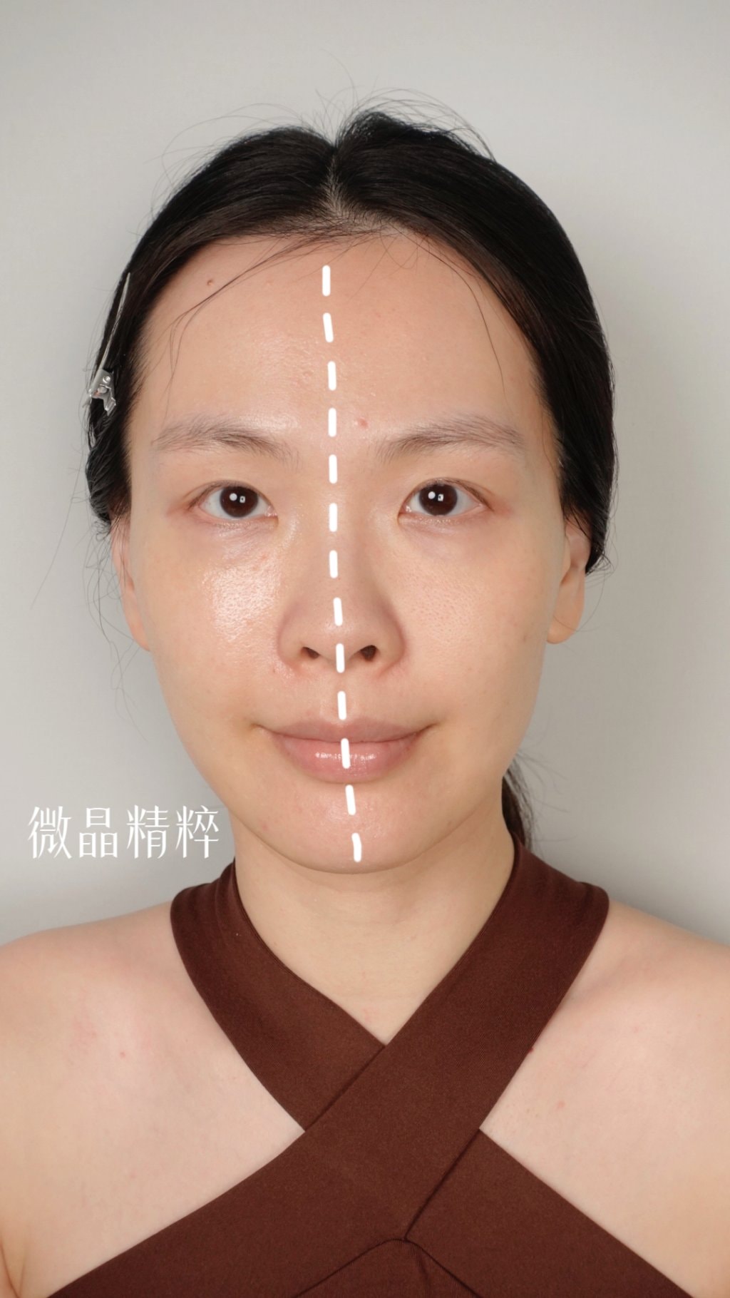 2024必敗！不痛的抗老微針保養！世界首創日本京藥妝牛磺酸微針，有感瞬拉緊緻！