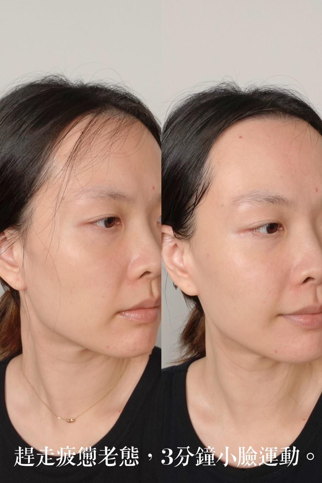 極萌大熨斗美容儀評價？微電流美容儀有用嗎？終於找到醫美的平替方案！