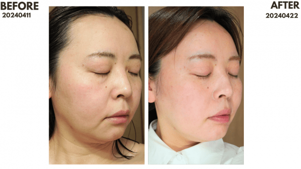 雙11限時額外8折｜ZIIP HALO & CurrentBody射頻儀+Wellness系列狂省數千～萬元！