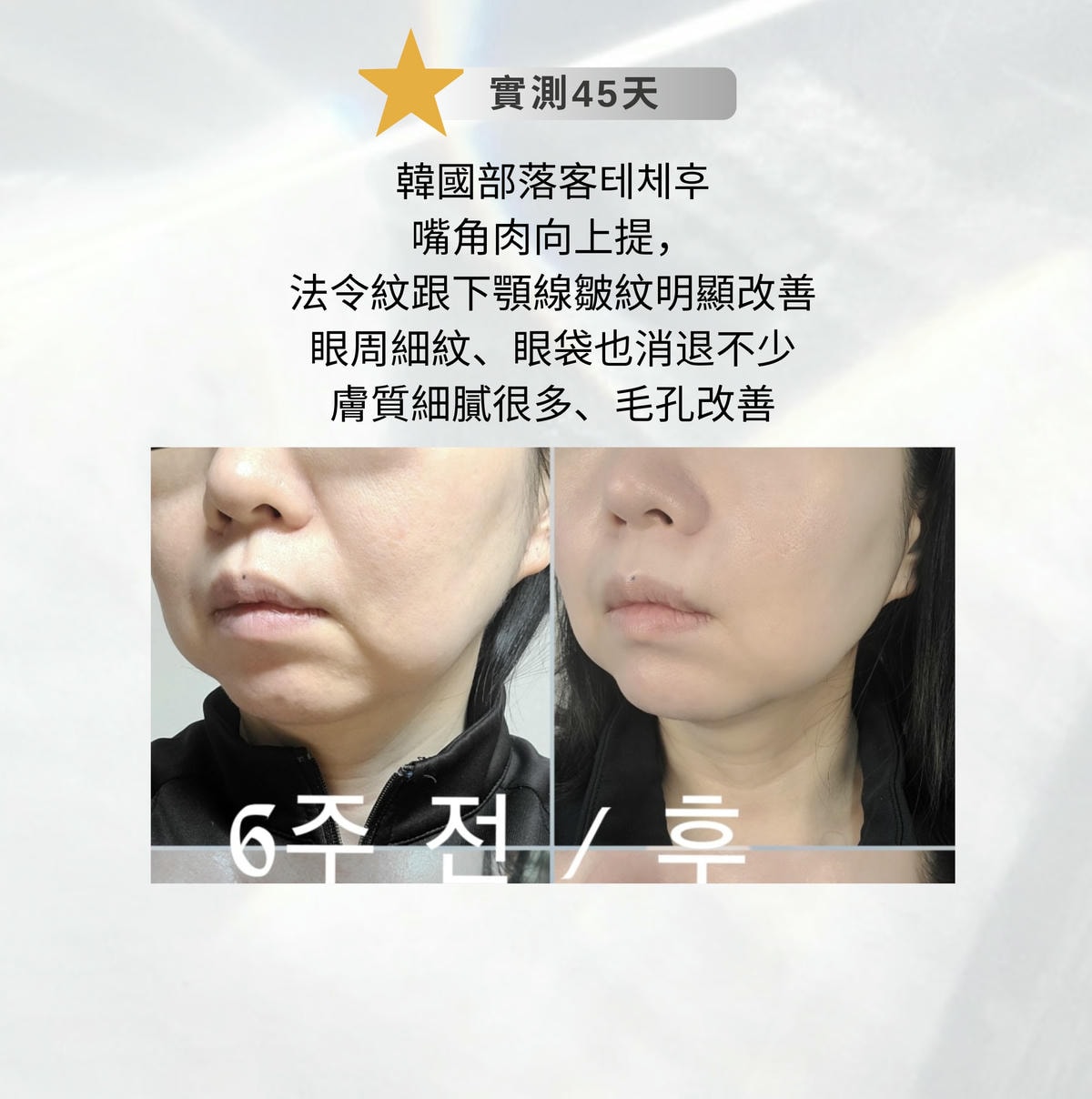 ZIIP HALO 美膚儀實測使用心得～居家美容、出國旅遊必備奈米微電流美膚儀！