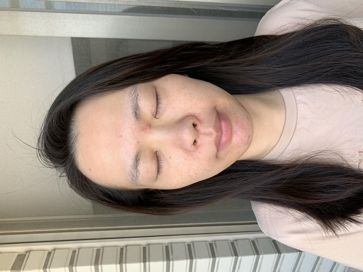 沒打水光針，卻亮回素顏巔峰！我怎麼靠「胎盤素噴霧」從酒糟肌養出發光肌？（文末優惠）