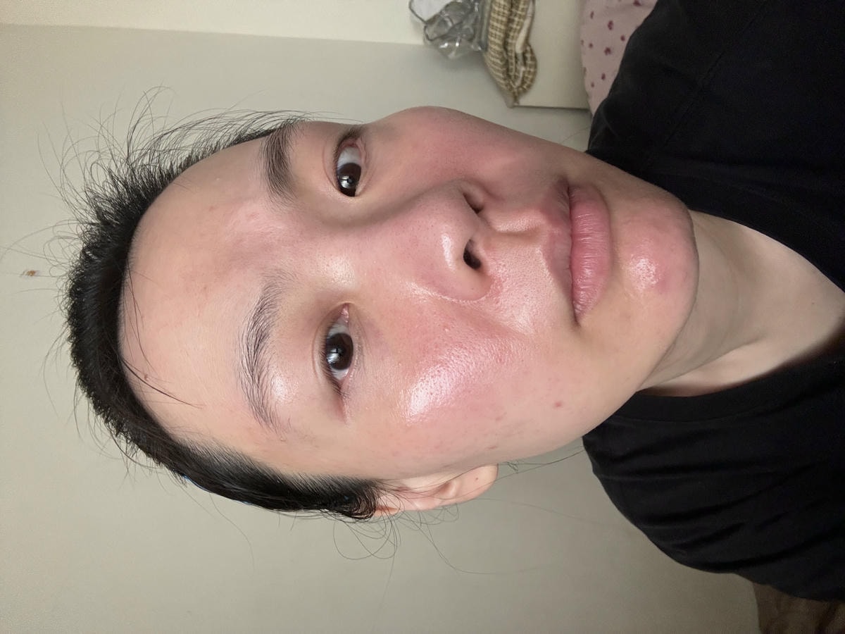 沒打水光針，卻亮回素顏巔峰！我怎麼靠「胎盤素噴霧」從酒糟肌養出發光肌？（文末優惠）
