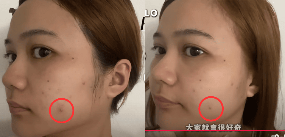 雙11限時額外8折｜ZIIP HALO & CurrentBody射頻儀+Wellness系列狂省數千～萬元！