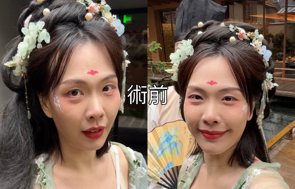 【醫美真心話】告別「見光死」大眼袋！38歲內開不補脂全紀錄：7 間診所諮詢心得＋超詳盡術前後保養清單