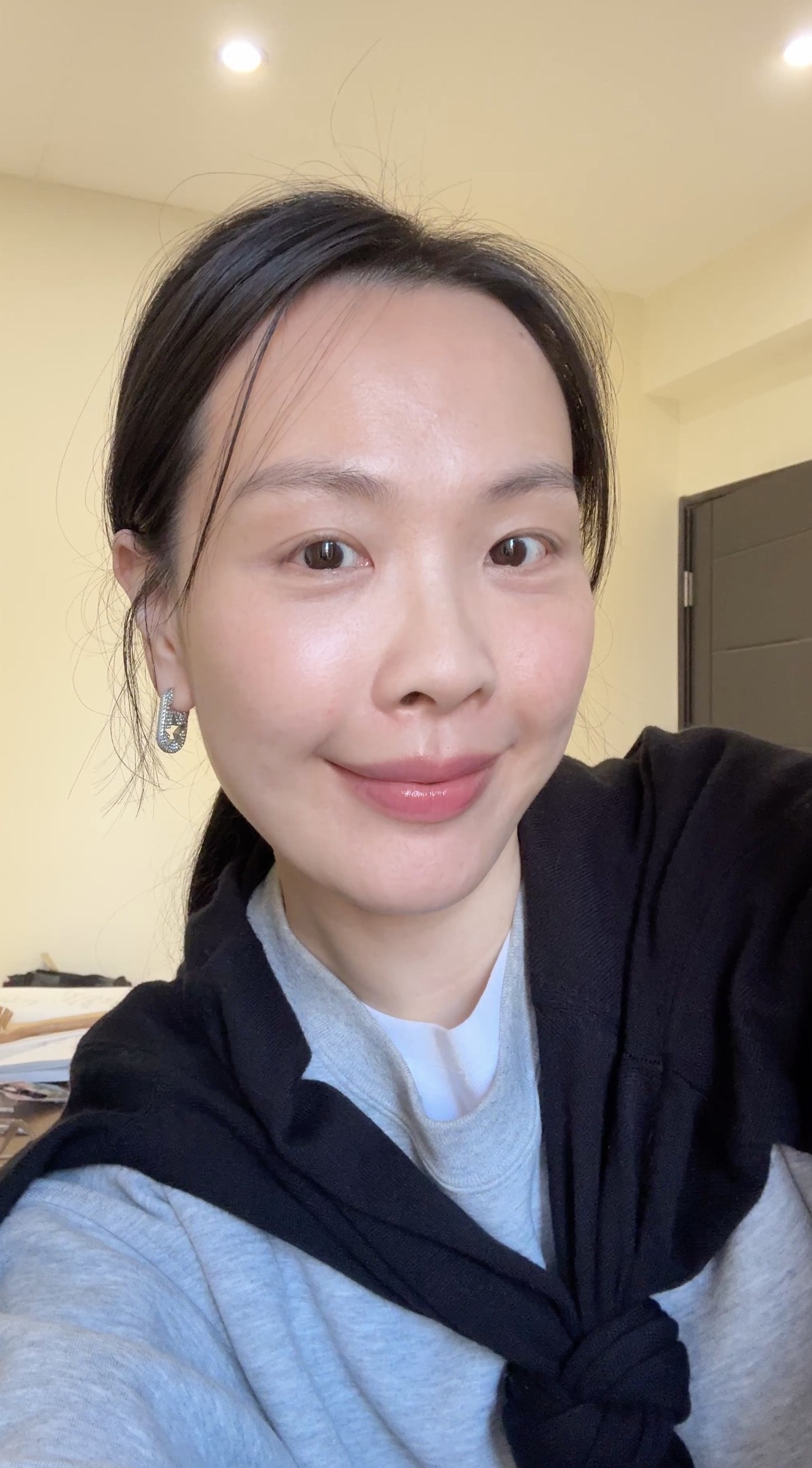 【醫美真心話】告別「見光死」大眼袋！38歲內開不補脂全紀錄：7 間診所諮詢心得＋超詳盡術前後保養清單