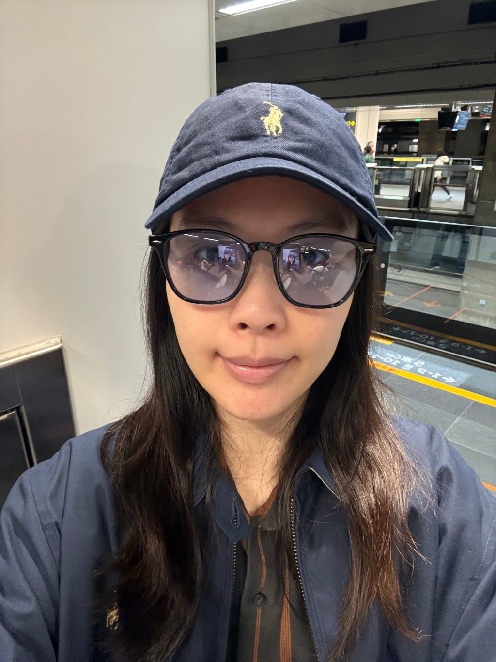 【醫美真心話】告別「見光死」大眼袋！38歲內開不補脂全紀錄：7 間診所諮詢心得＋超詳盡術前後保養清單