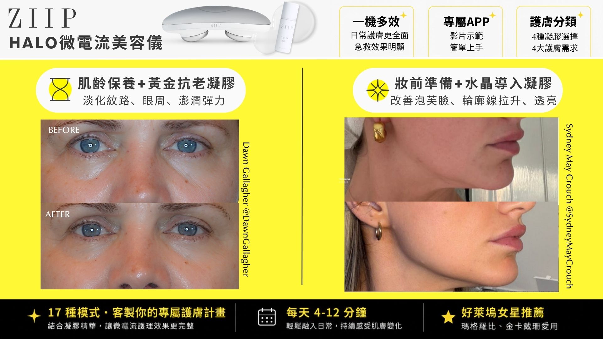 【週年實測】ZIIP HALO 美膚儀：邁入 40 歲的動態保養哲學，醫美後的溫和維持戰友