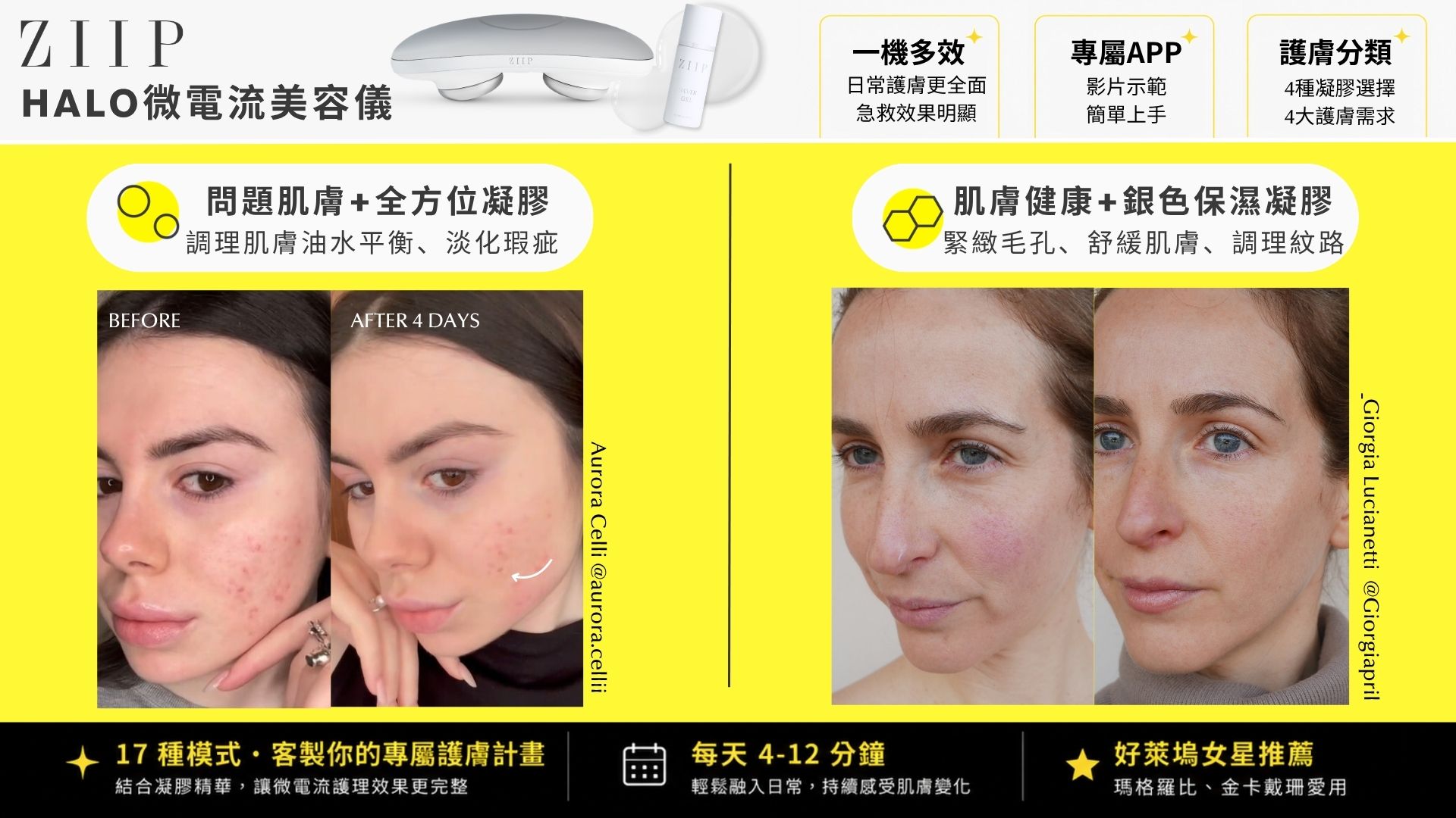 【週年實測】ZIIP HALO 美膚儀：邁入 40 歲的動態保養哲學，醫美後的溫和維持戰友